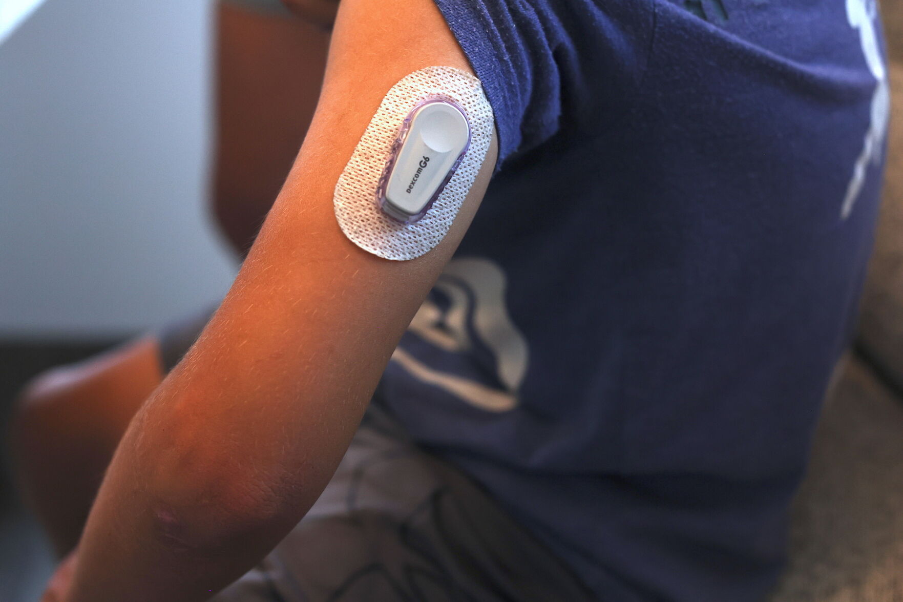 Dexcom T1D